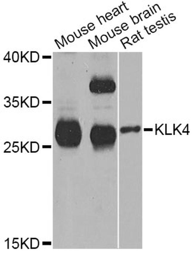 Kallikrein 4 Antibody in Western Blot (WB)