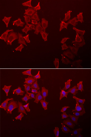 LECT1 Antibody in Immunocytochemistry (ICC/IF)