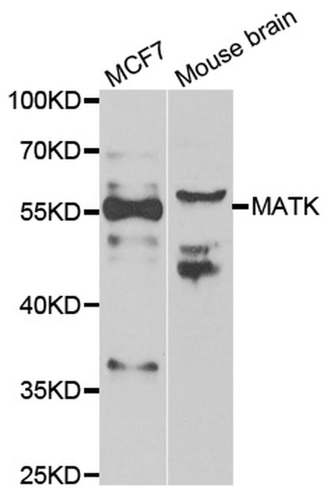 MATK Antibody in Western Blot (WB)