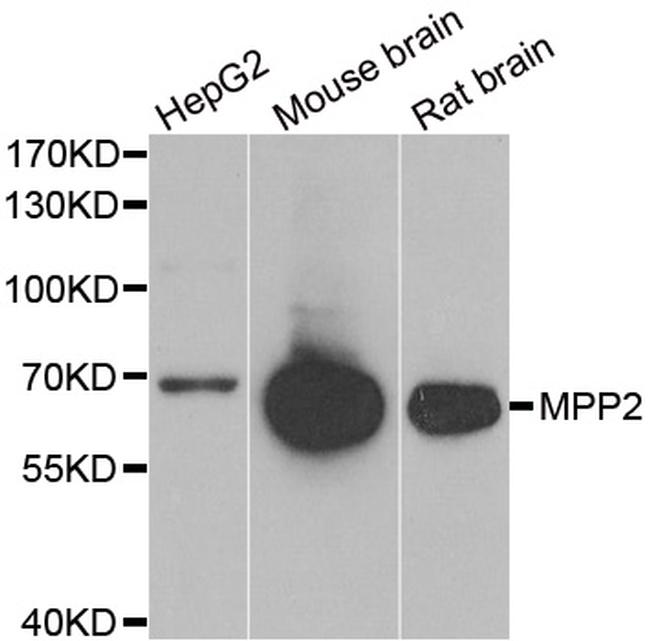 MPP2 Antibody in Western Blot (WB)