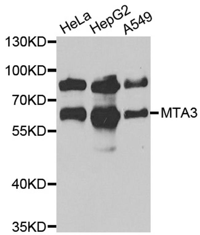 MTA3 Antibody in Western Blot (WB)