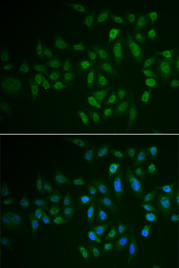 MLCK Antibody in Immunocytochemistry (ICC/IF)