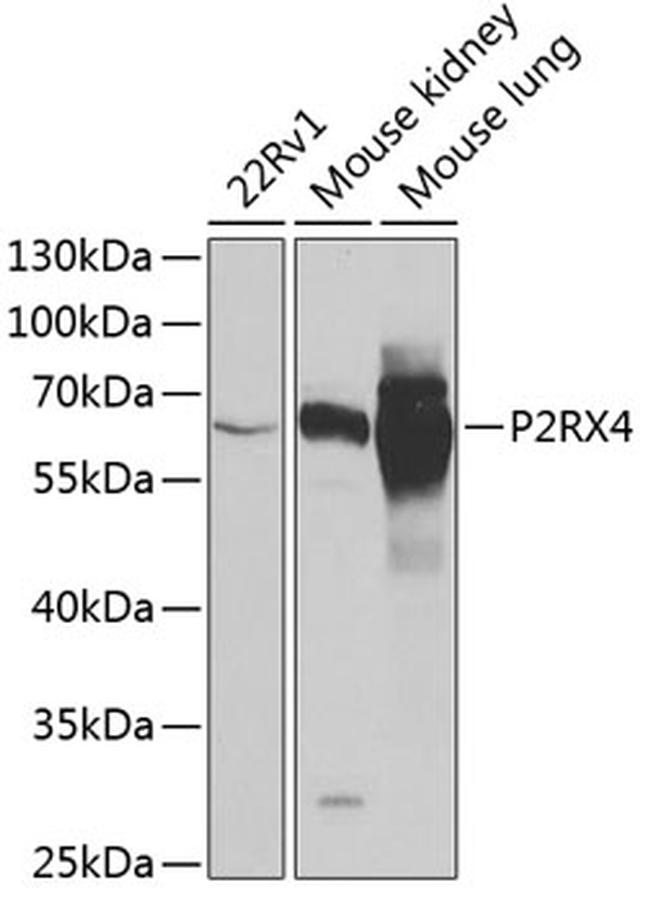 P2X4 Antibody in Western Blot (WB)