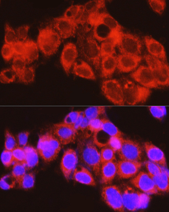 PYGL Antibody in Immunocytochemistry (ICC/IF)