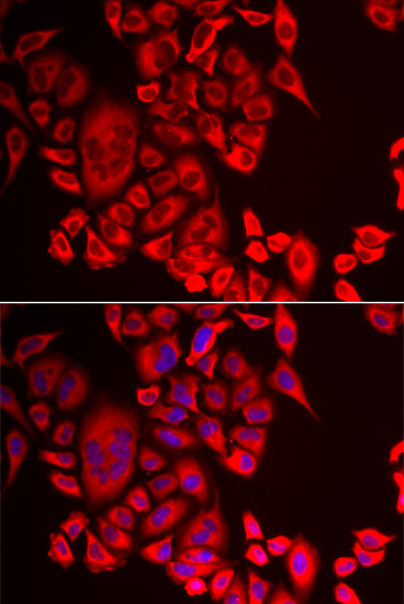 QPCT Antibody in Immunocytochemistry (ICC/IF)