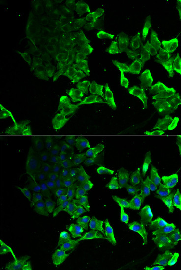 SCYL1 Antibody in Immunocytochemistry (ICC/IF)