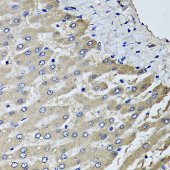 SCYL1 Antibody in Immunohistochemistry (Paraffin) (IHC (P))