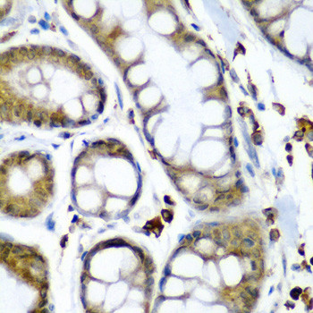 SBP2 Antibody in Immunohistochemistry (Paraffin) (IHC (P))