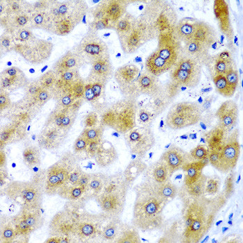 SBP2 Antibody in Immunohistochemistry (Paraffin) (IHC (P))