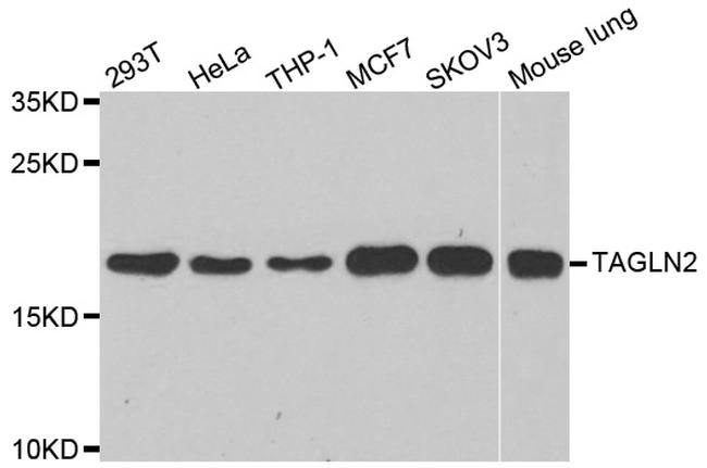 TAGLN2 Antibody in Western Blot (WB)