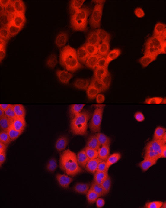 TDO2 Antibody in Immunocytochemistry (ICC/IF)