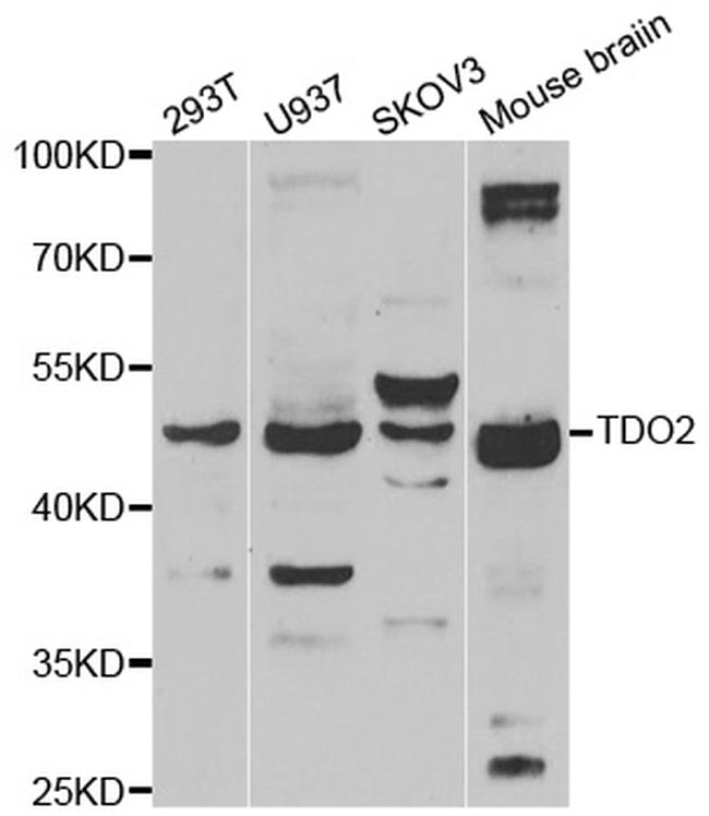 TDO2 Antibody in Western Blot (WB)