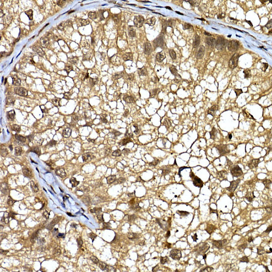 DCAF7 Antibody in Immunohistochemistry (Paraffin) (IHC (P))