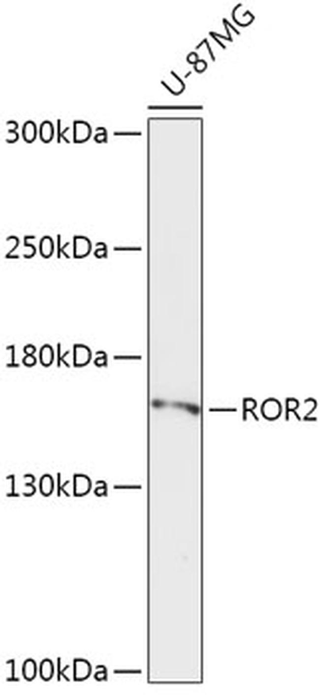 ROR2 Antibody in Western Blot (WB)