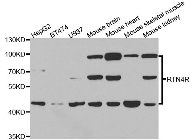 Nogo Receptor Antibody in Western Blot (WB)