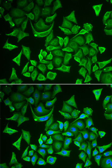 DTYMK Antibody in Immunocytochemistry (ICC/IF)