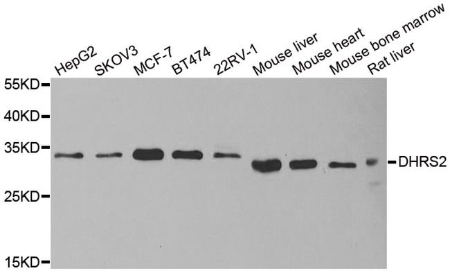DHRS2 Antibody in Western Blot (WB)