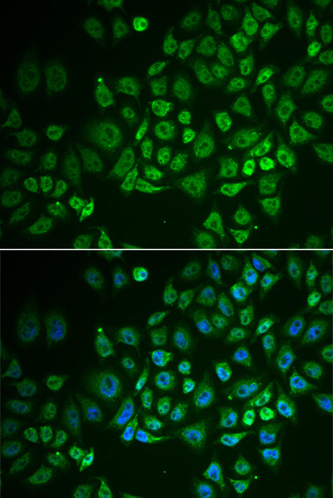 GPLD1 Antibody in Immunocytochemistry (ICC/IF)