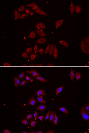 NPHP1 Antibody in Immunocytochemistry (ICC/IF)