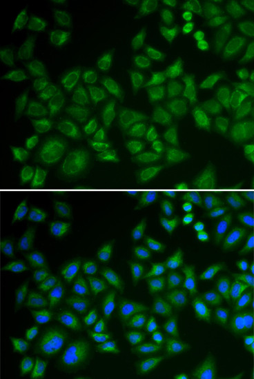 ASM Antibody in Immunocytochemistry (ICC/IF)