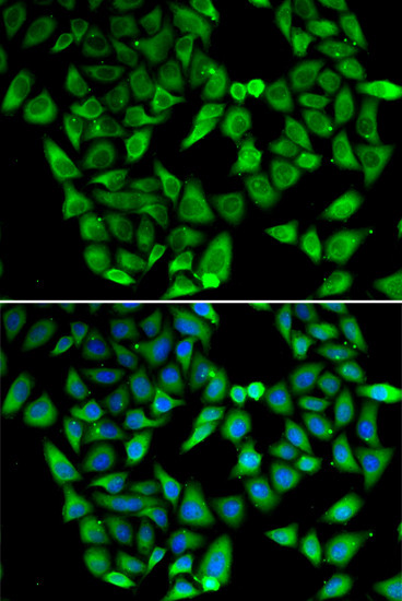 ASIP Antibody in Immunocytochemistry (ICC/IF)