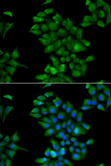 CTNS Antibody in Immunocytochemistry (ICC/IF)