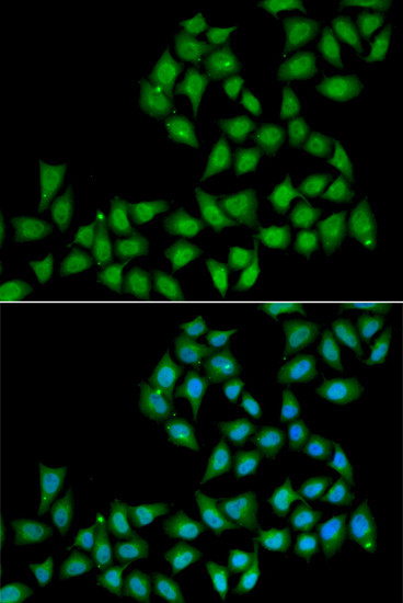 ELF1 Antibody in Immunocytochemistry (ICC/IF)