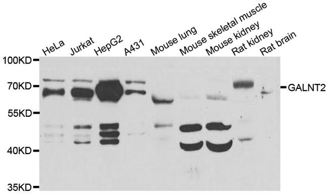 GALNT2 Antibody in Western Blot (WB)