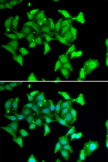 MYO1C Antibody in Immunocytochemistry (ICC/IF)