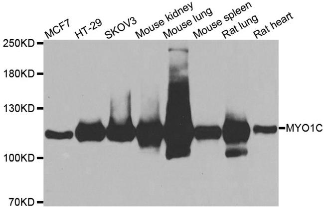 MYO1C Antibody in Western Blot (WB)