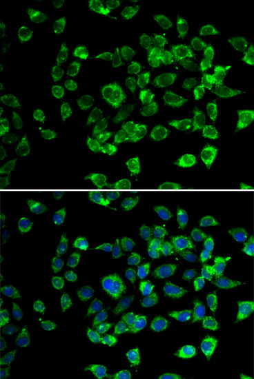 PSMD13 Antibody in Immunocytochemistry (ICC/IF)