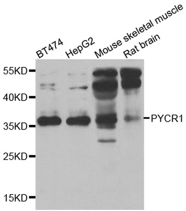 PYCR1 Antibody in Western Blot (WB)