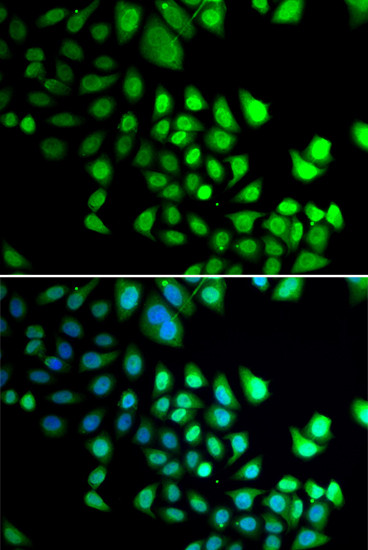 RBBP5 Antibody in Immunocytochemistry (ICC/IF)