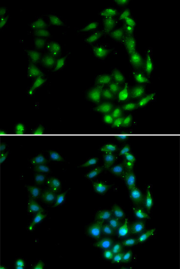 SOX5 Antibody in Immunocytochemistry (ICC/IF)