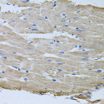 TARS Antibody in Immunohistochemistry (Paraffin) (IHC (P))