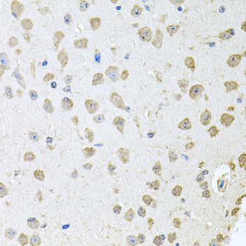 TARS Antibody in Immunohistochemistry (Paraffin) (IHC (P))