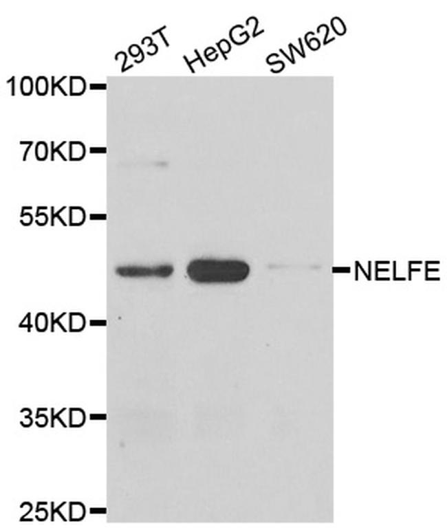 RDBP Antibody in Western Blot (WB)