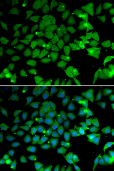 ARD1A Antibody in Immunocytochemistry (ICC/IF)