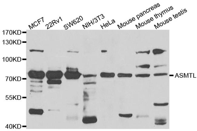 ASMTL Antibody in Western Blot (WB)