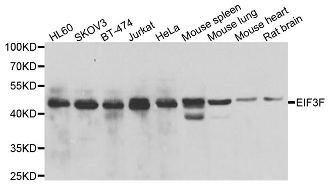 eIF3f Antibody in Western Blot (WB)