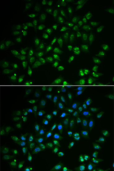 HAND2 Antibody in Immunocytochemistry (ICC/IF)