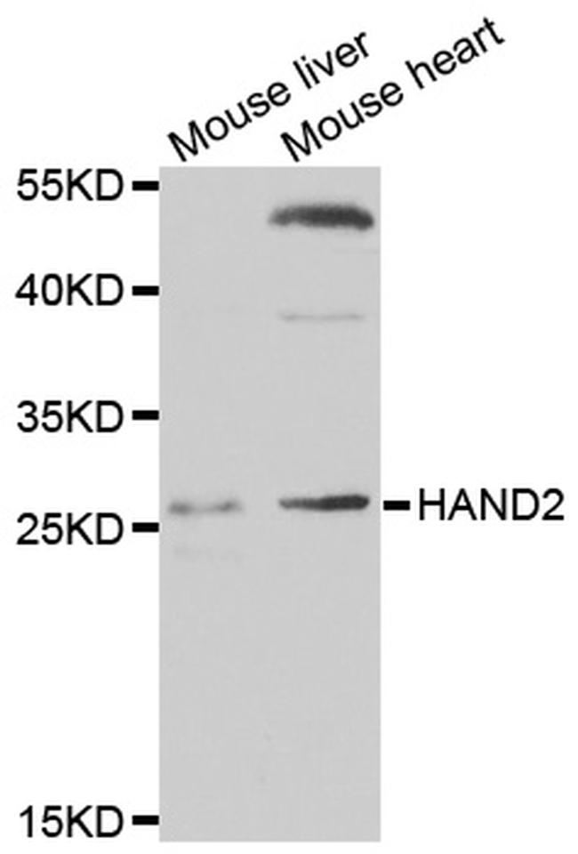 HAND2 Antibody in Western Blot (WB)