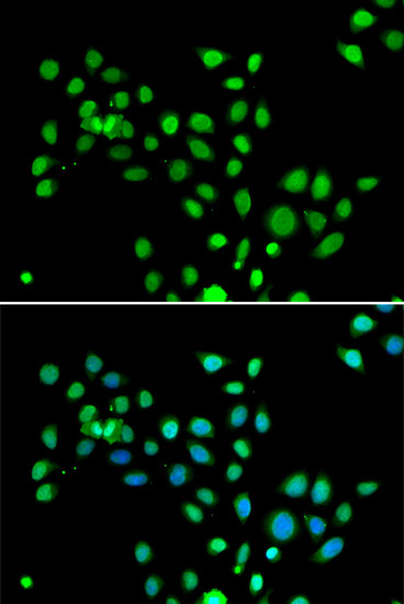 Histone Macro-H2A.1 Antibody in Immunocytochemistry (ICC/IF)