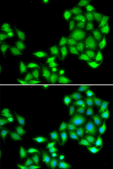 OGFR Antibody in Immunocytochemistry (ICC/IF)