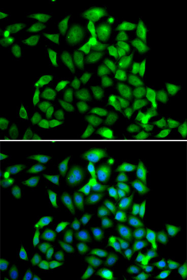 CLASP1 Antibody in Immunocytochemistry (ICC/IF)