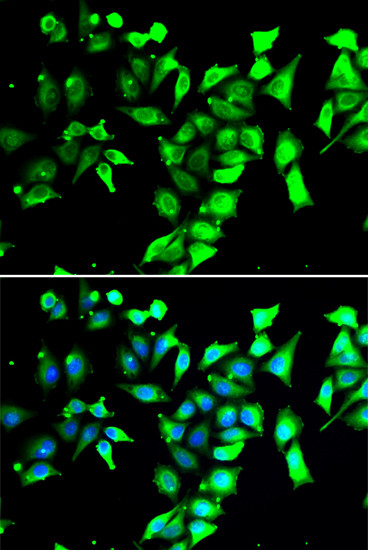 FKBP8 Antibody in Immunocytochemistry (ICC/IF)