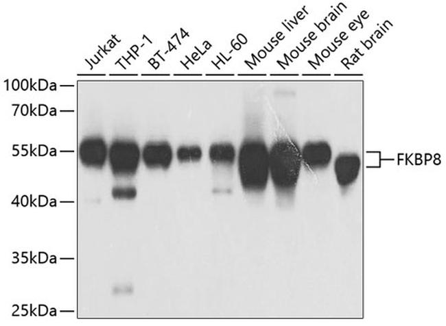 FKBP8 Antibody in Western Blot (WB)