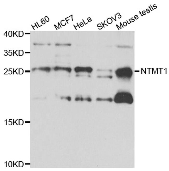 NTMT1 Antibody in Western Blot (WB)