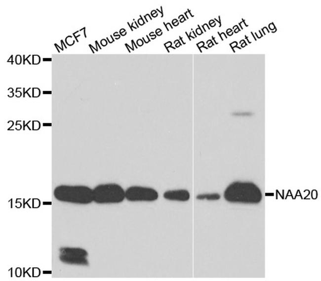 NAA20 Antibody in Western Blot (WB)