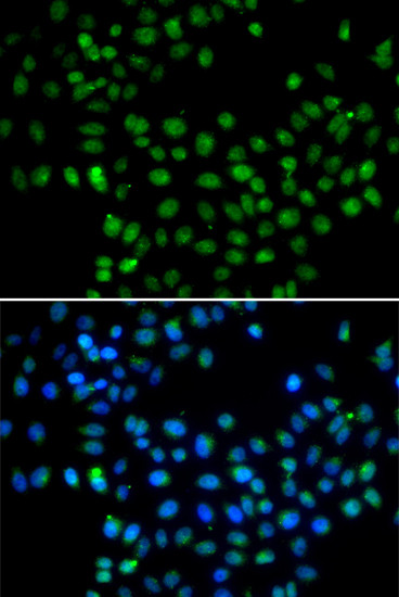 EAF2 Antibody in Immunocytochemistry (ICC/IF)